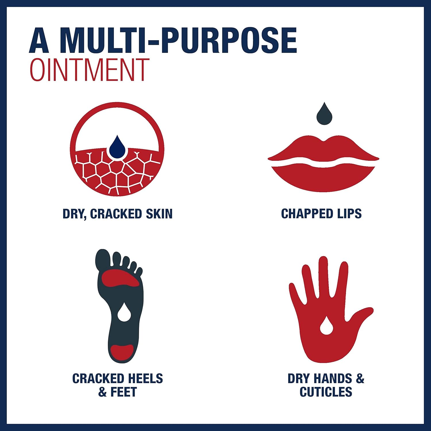 Aquaphor Healing Ointment, Advanced Therapy Skin Protectant, Multi-Purpose Healing Ointment and Body Moisturizer, For Dry, Cracked Skin, Minor Cuts and Burns, 14 Oz Jar - Equate - Nimbus Distributors - wholesale and distributors in United States Aquaphor Healing Ointment, Advanced Therapy Skin Protectant, Multi-Purpose Healing Ointment and Body Moisturizer, For Dry, Cracked Skin, Minor Cuts and Burns, 14 Oz Jar - Equate - Nimbus Distributors - wholesale and distributors in United States